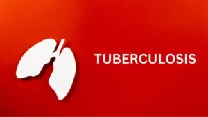 tuberculosis-treatment-mumbai