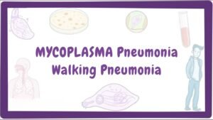 mycoplasma-pneumonia