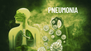 best-pneumonia-doctor-mumbai