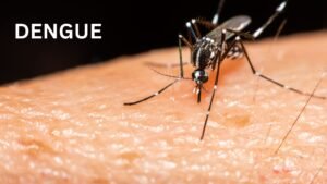 dengue-treatment-doctor-mumbai
