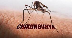 chikungunya-doctor-mumbai-dr-swapnil-gautam