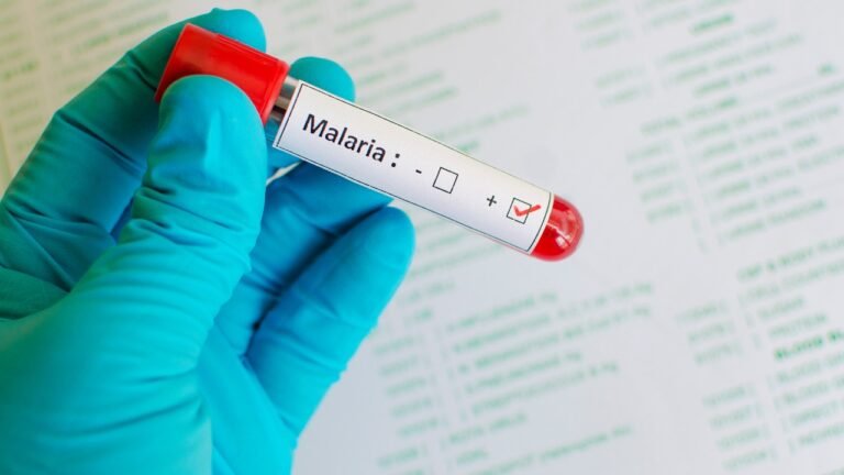 best malaria doctor in andheri