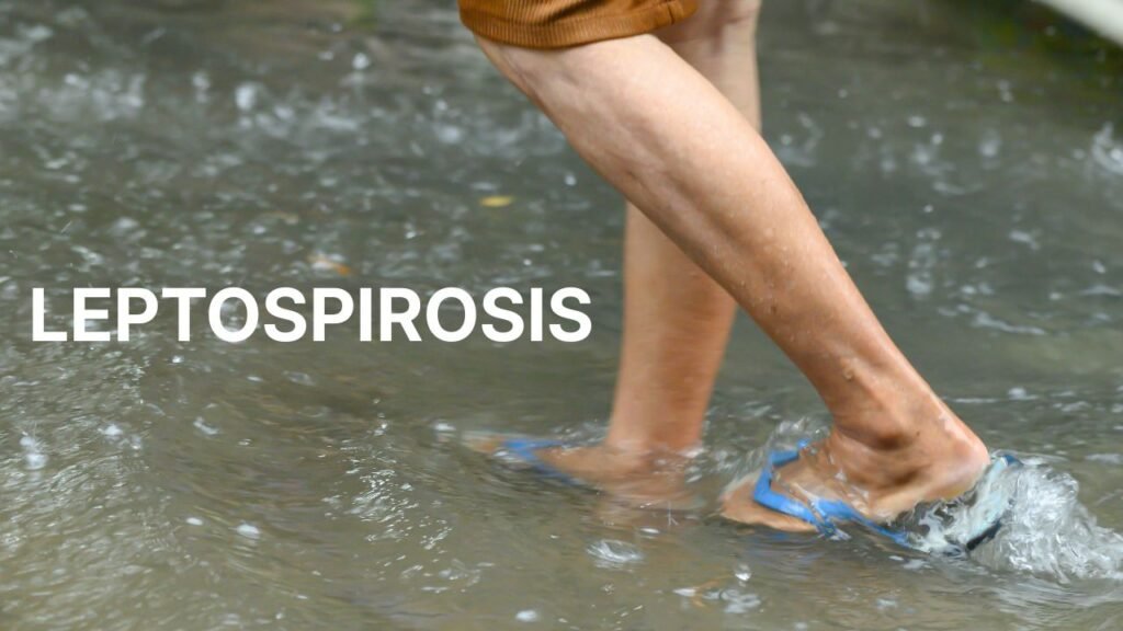 Leptospirosis symptoms, diagnosis, treatment, and prevention guide